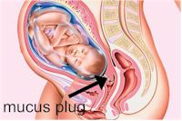 mucus plug