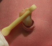 freshly clamped umbilical cord small